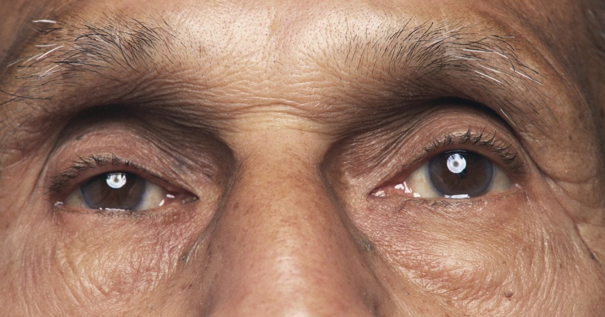 O bacterie din ochi, asociată cu declinul cognitiv și boala Alzheimer Prezența bacteriei Chlamydia pneumoniae în retină ar putea indica un risc crescut de declin cognitiv și boală Alzheimer, conform unui studiu realizat de cercetătorii de la Cedars-Sinai Medical Center din Statele Unite