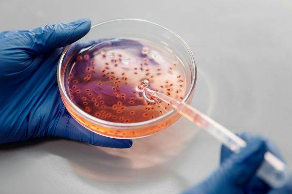 O descoperire surprinzătoare despre rezistența microorganismelor a fost făcută recent în Antarctica, unde o echipă de cercetători australieni a identificat bacterii capabile să supraviețuiască în condiții extreme, consumând gaze din atmosferă și rezistând la variații de temperatură de neoprit pentru organismele de pe planetă