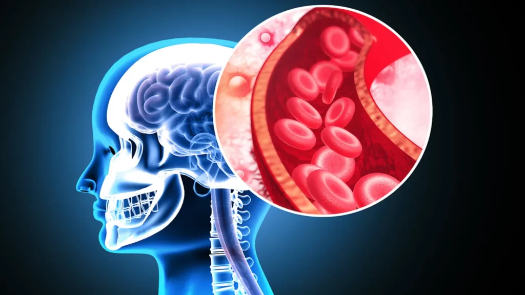 Suplimentul care reduce cu 43% riscul de infarct și AVC