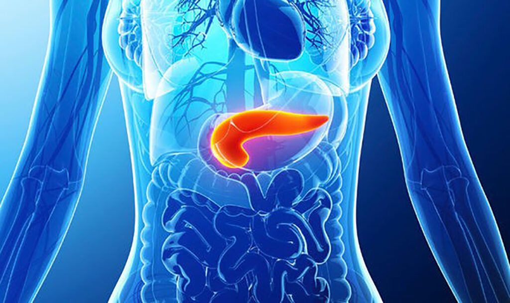 Descoperire revoluționară în lupta cu cancerul pancreatic: un „comutator genetic” care explică rezistența la chimioterapie Un pas major în înțelegerea mecanismelor de rezistență la tratament în cazul cancerului pancreatic a fost realizat recent de o echipă internațională de cercetători