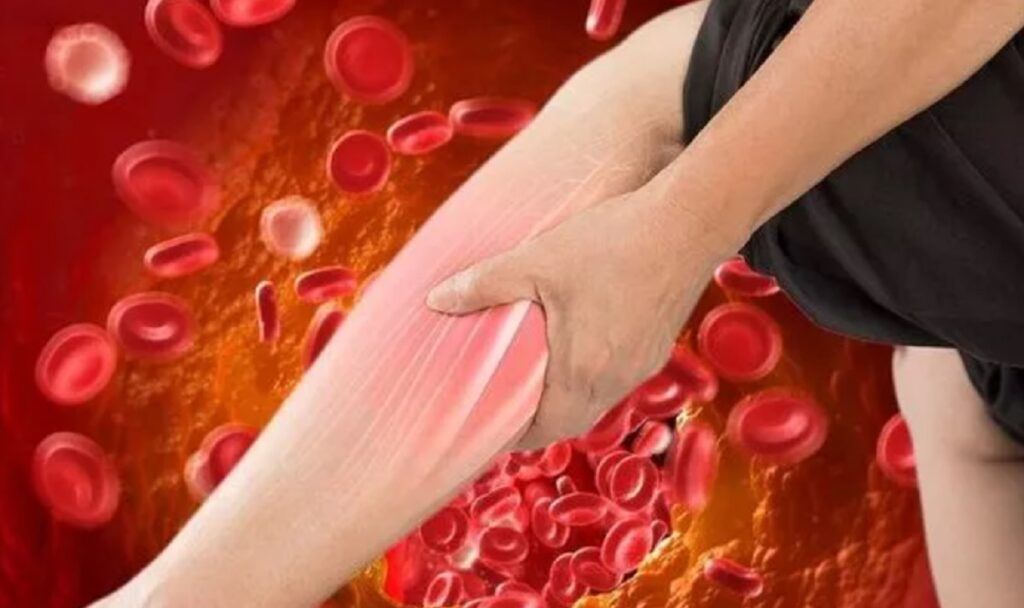 Colesterolul LDL, adesea numit și „colesterol rău”, reprezintă un factor de risc major pentru afecțiuni cardiovasculare, însă realitatea din teren indică faptul că multe persoane nu sunt conștiente de prezența sa în organism