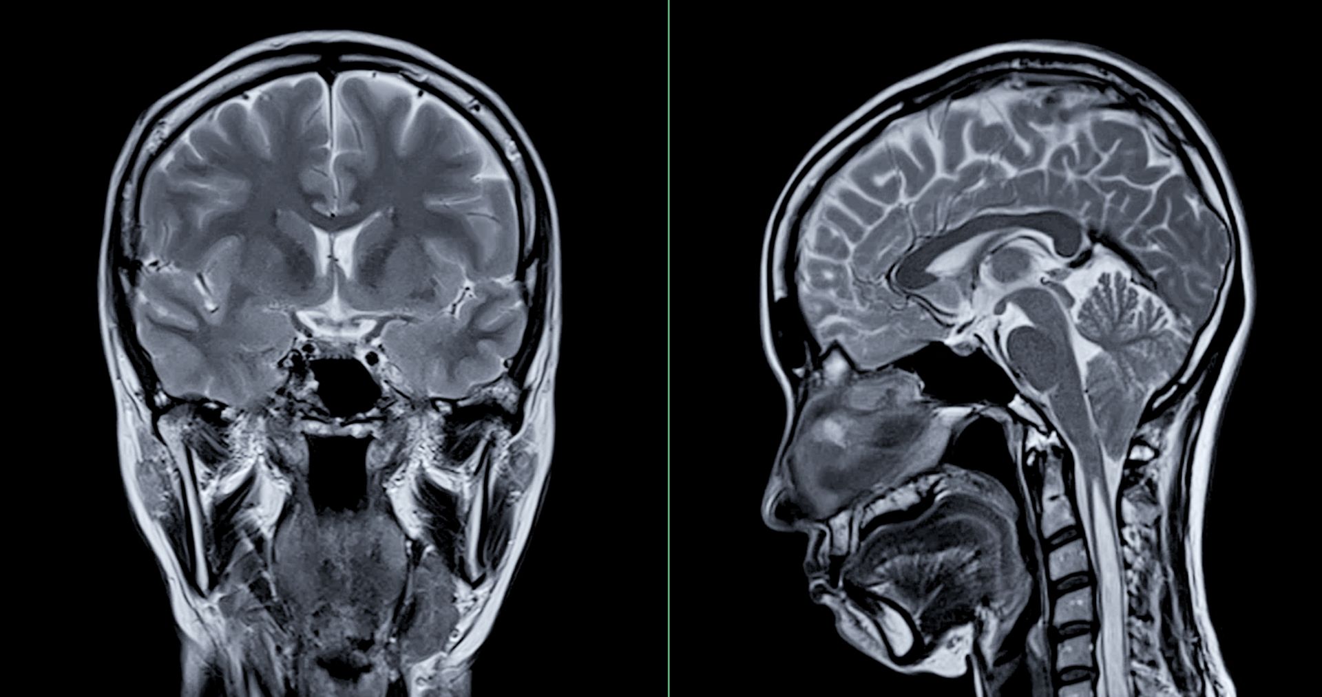 O poveste aproape incredibilă despre sănătate mentală și misterele minții a ieșit recent la lumină, relevând complexitatea legăturii dintre corp și minte în cazul unei femei care, la aproape 40 de ani, a început să audă voci care i-au salvat viața