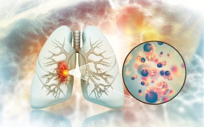 Cancerul pulmonar la nefumători: Legătură ȘOCANTĂ cu fructe și legume