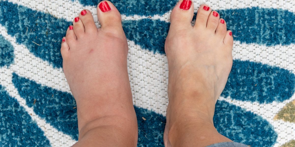 Semnele ascunse pe picioare care pot semnala probleme grave de sănătate