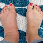 Semnele-ascunse-de-pe-picioare-care-pot-indica-probleme-grave-de-sanatate.-La-ce-trebuie-sa-fii-aten.jpeg - ReactiveNews