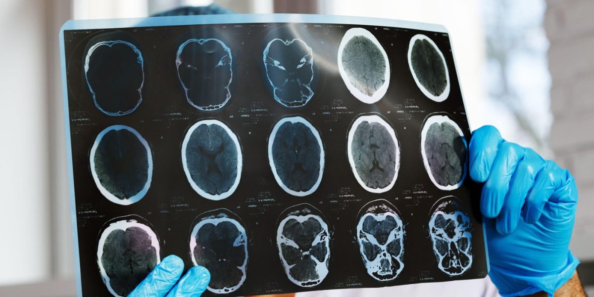 aGFzaD0wMWY1YzUxNWQ0NjdjNjZhMzc4YzgzYmRlODU5MzlhZQ.thumb_.jpg - ReactiveNews