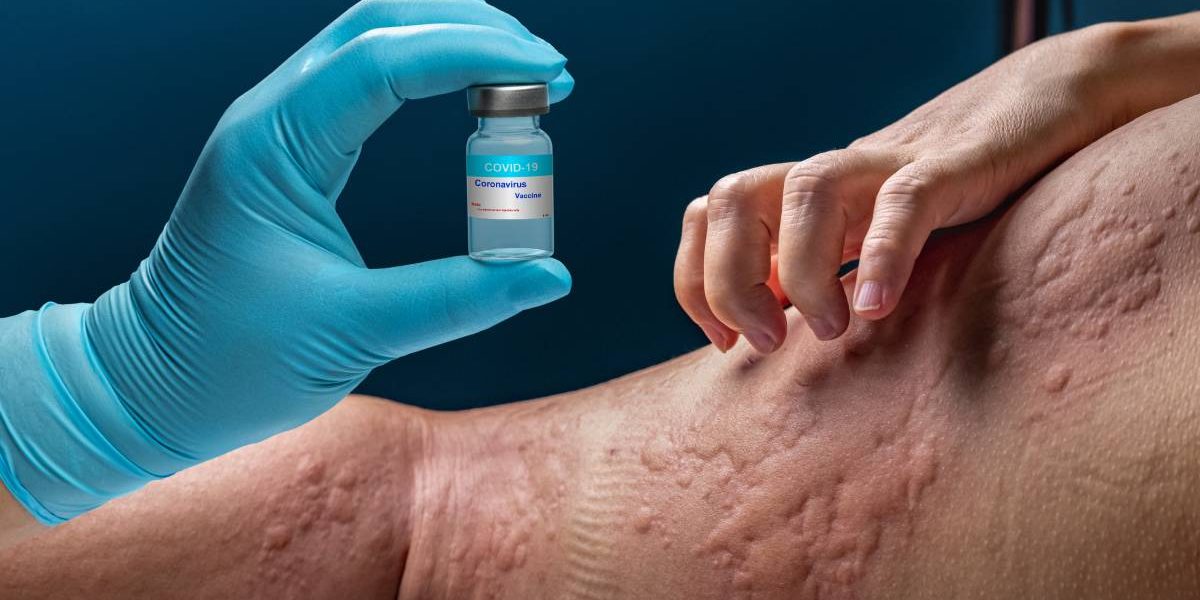 alergii.jpg - ReactiveNews