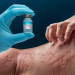 alergii.jpg - ReactiveNews