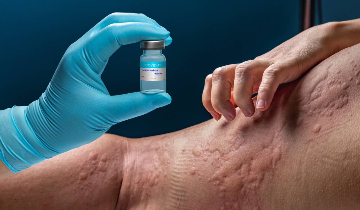 O tânără duce o luptă zilnică cu peste 40 de alergii O femeie din România trăiește de ani buni cu un complex de alergii care i-au afectat viața și sănătatea, fiind aproape imposibil pentru ea să consume alimente considerate uzuale pentru majoritatea oamenilor