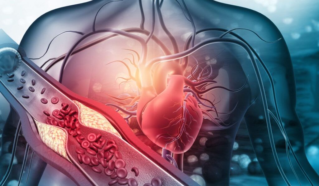 Prevenția cardiovasculară: Cheia pentru o viață mai lungă și mai sănătoasă Ateroscleroza, o boală silențioasă care poate conduce la infarct miocardic sau accident vascular cerebral (AVC), poate fi prevenită printr-o serie de măsuri simple și decizii luate zilnic