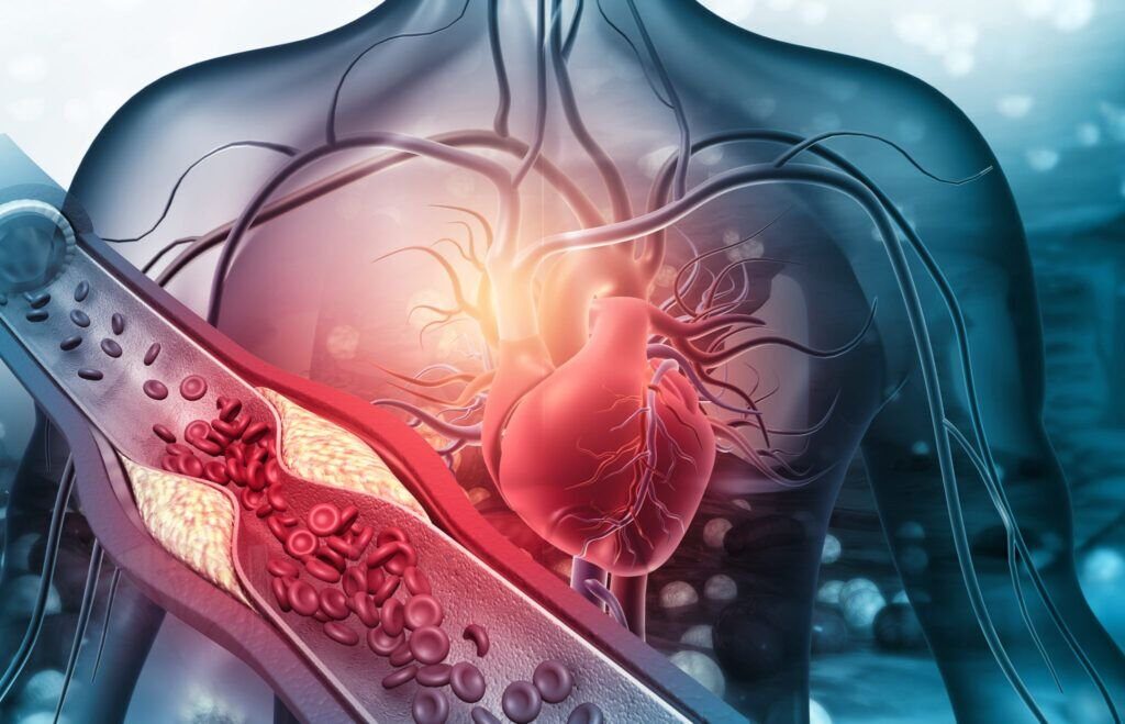 Prevenția cardiovasculară: Cheia pentru o viață mai lungă și mai sănătoasă Ateroscleroza, o boală silențioasă care poate conduce la infarct miocardic sau accident vascular cerebral (AVC), poate fi prevenită printr-o serie de măsuri simple și decizii luate zilnic