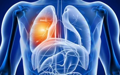 Răbufnirea COVID-19: Ce se întâmplă cu plămânii după boală