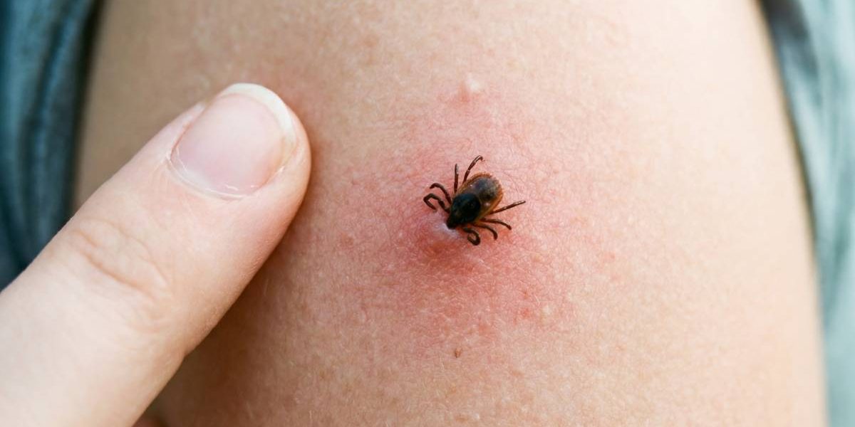 Evită țânțarii, căpușele și păianjenii: sfaturi de la medici.