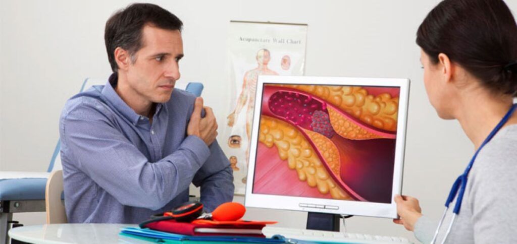 Cardiologii americani cer noi reguli pentru colesterol și reducerea riscului de infarct și AVC