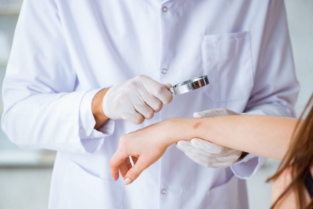 Ectima, boala de piele sâcâitoare: Cauze și tratamente eficiente