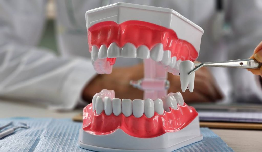 Extracție sau nu? Ortodonția, dilema medicilor: ce spun și de ce