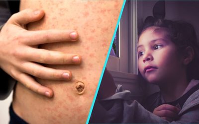 Rușinos: Dr. Alexiu: „Copii cu plămâni distruși, din cauza nevaccinării”