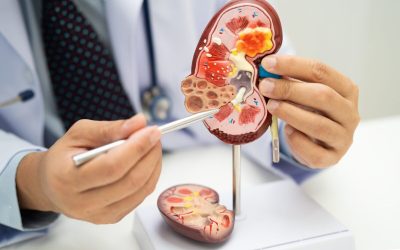 Acid uric vs creatinină: ce semnale trimit analizele despre rinichi