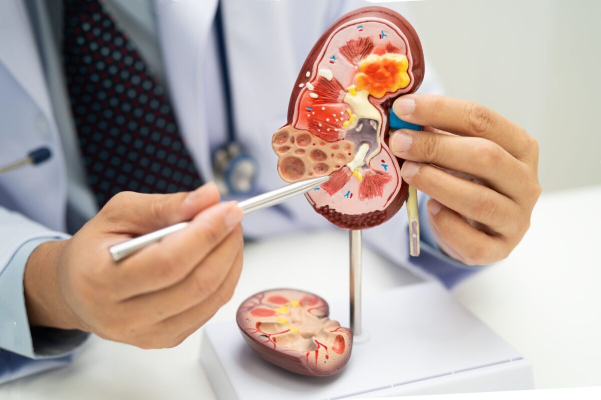 Acid uric vs creatinină: ce semnale trimit analizele despre rinichi