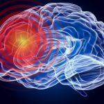 Nouă tulburare neurologică, necunoscută până acum, descoperită