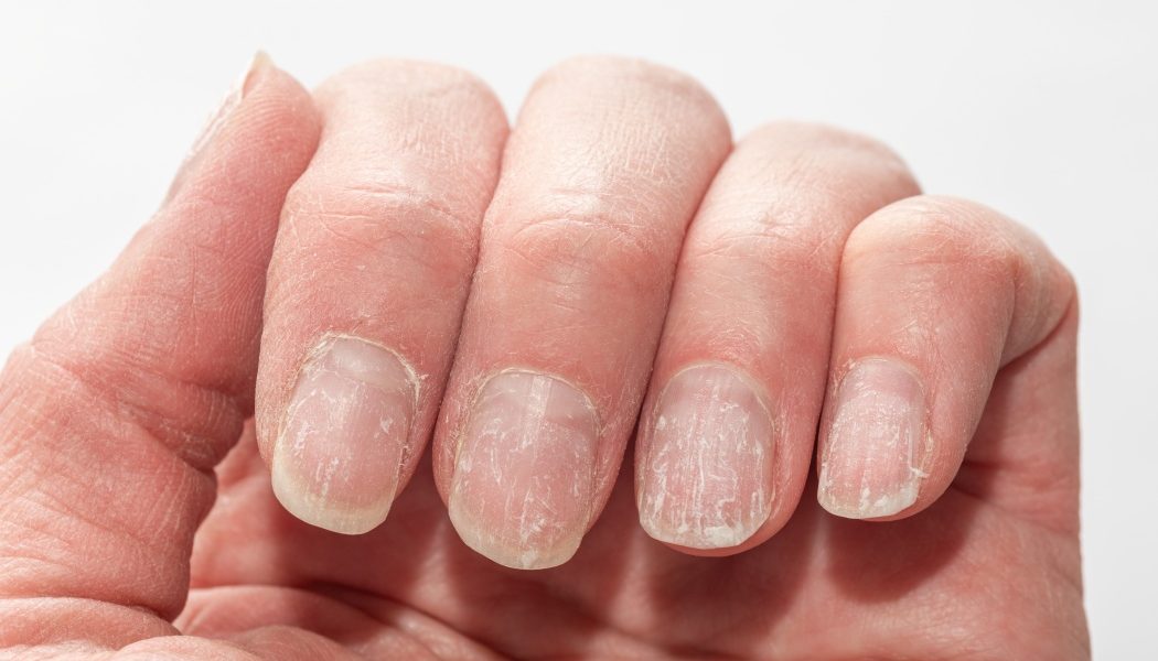 unghii.jpg - ReactiveNews