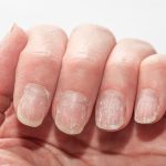 unghii.jpg - ReactiveNews