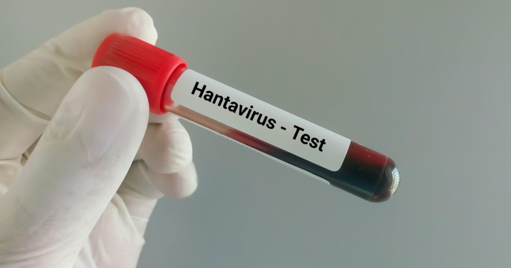 Hantavirus la Arad: Ancheta autorităților după suspiciuni. Ce spun medicii?