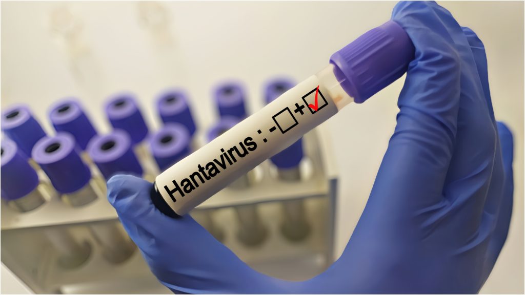 Hantavirus în Bihor: Pacient sub supraveghere, Institutul Cantacuzino așteaptă rezultate