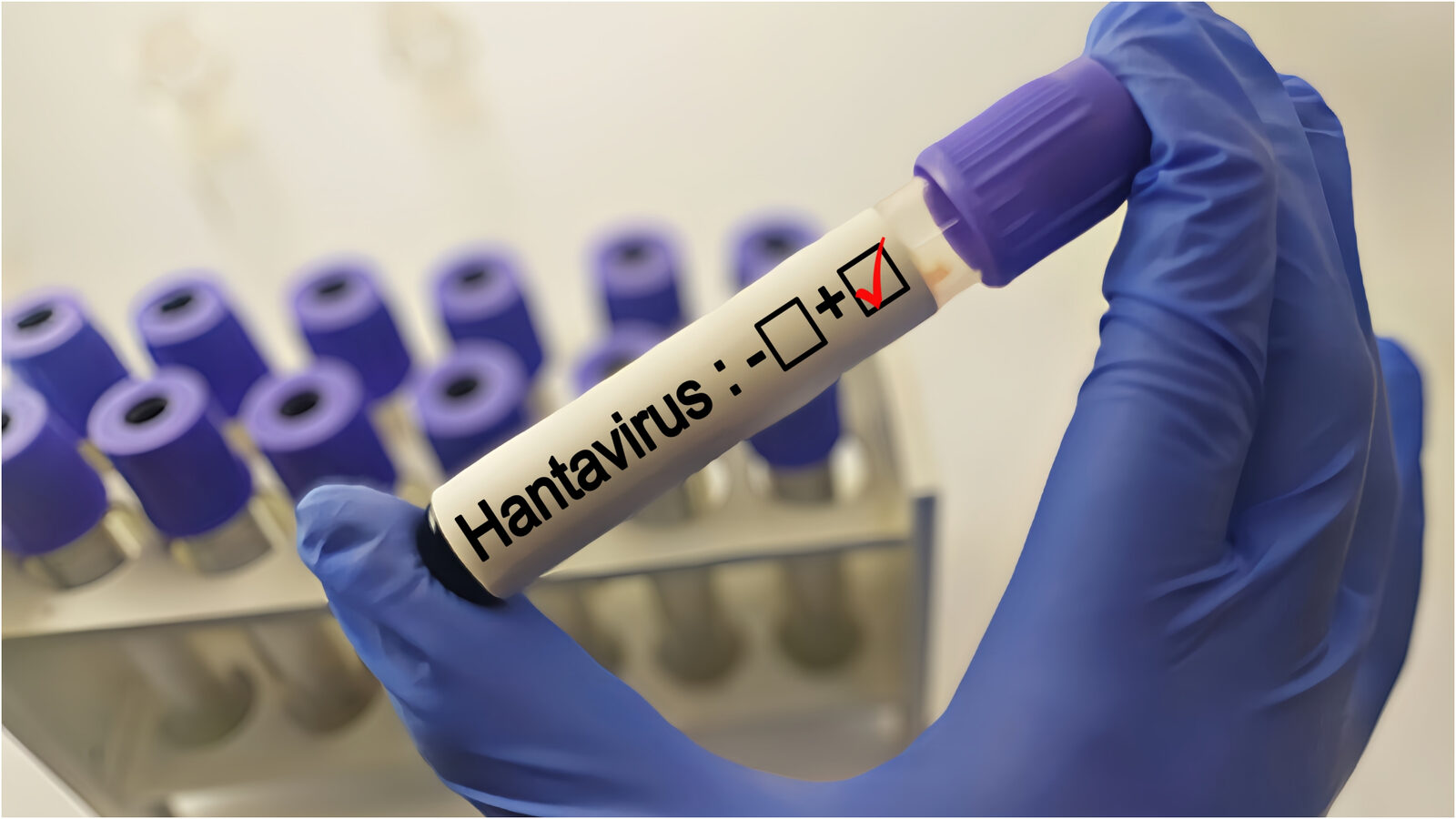 Hantavirus în Bihor: Pacient sub supraveghere, Institutul Cantacuzino așteaptă rezultate
