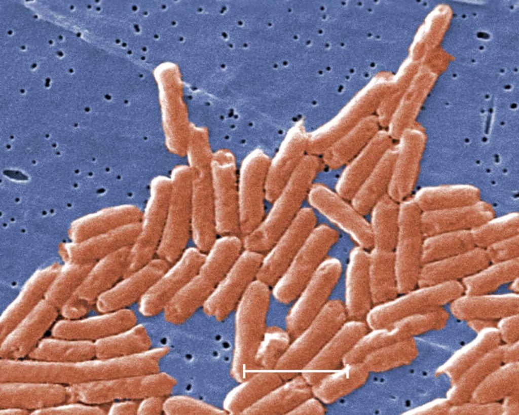 Salmonella, inamicul din farfurie: rezistența la antibiotice crește alarmant