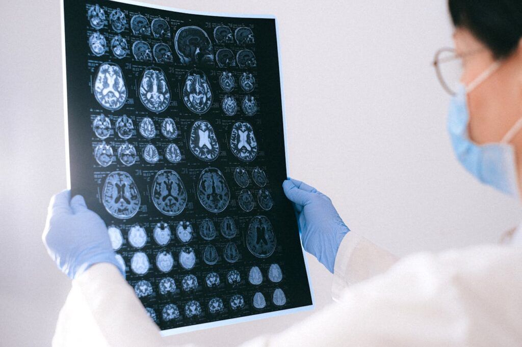 Hollywood: Actor legendar, diagnosticat cu Alzheimer după Oscar