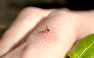 Curte fără viespi și țânțari: Soluții naturale de la specialiști
