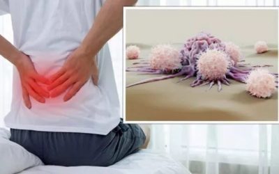 Cancer tăcut: 5 semne ascunse în dureri comune