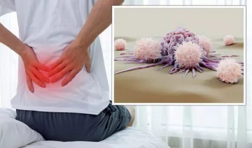Cancer tăcut: 5 semne ascunse în dureri comune