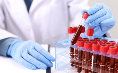 Mister sângeros: S-a rezolvat enigma grupei sanguine, medicina modernă uimită