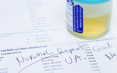 Test urină: 9 din 10 cancere vezică depistate